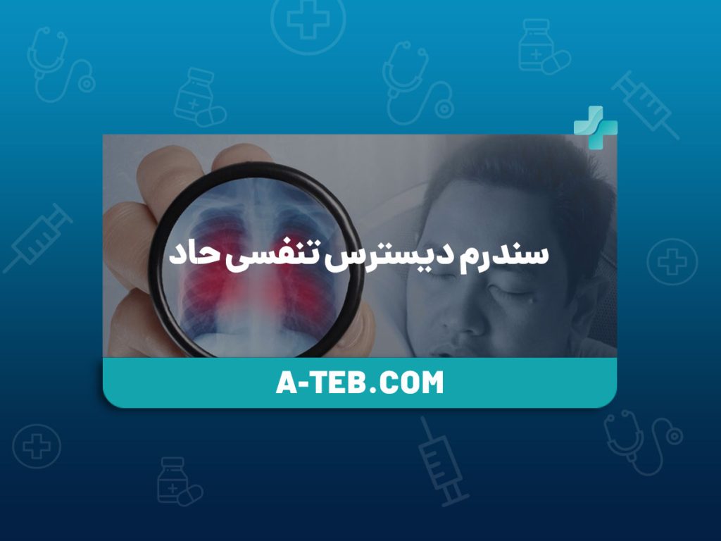 سندرم دیسترس تنفسی حاد