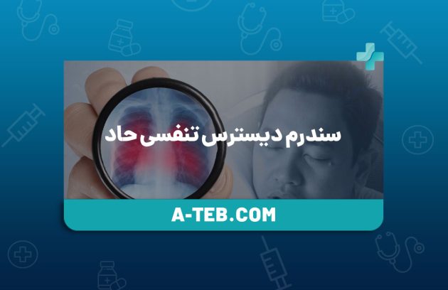 سندرم دیسترس تنفسی حاد