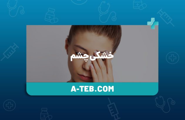 خشکی چشم