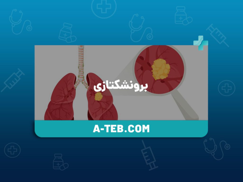 برونشکتازی