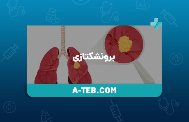 برونشکتازی