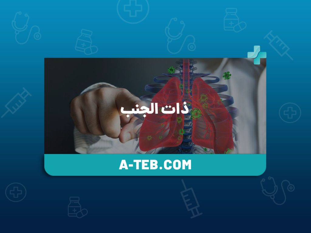 ذات الجنب