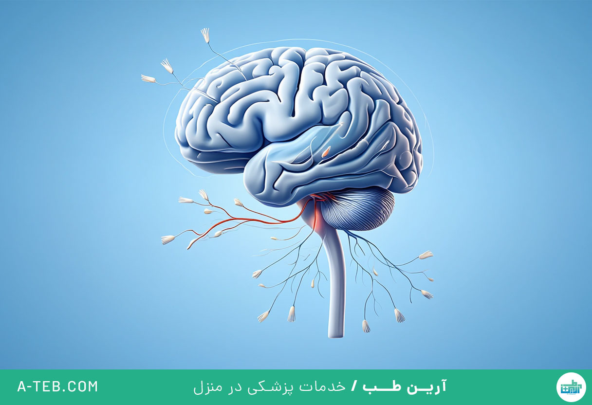 درمان ام اس