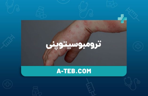 ترومبوسیتوپنی