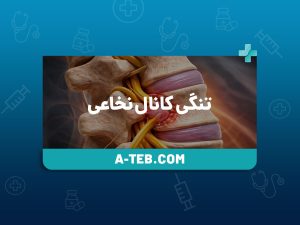 تنگی کانال نخاعی