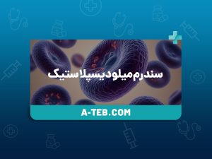 سندرم میلودیسپلاستیک