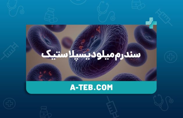 سندرم میلودیسپلاستیک