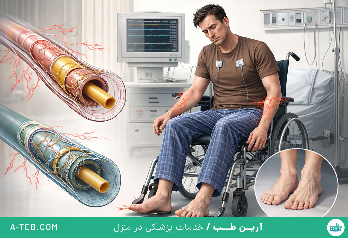 درمان سندرم گیلن باره