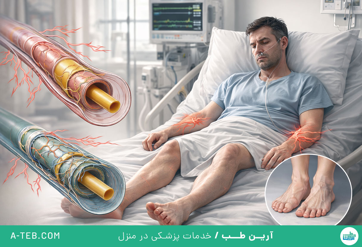 علت سندرم گیلن باره