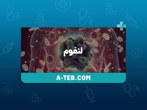 لنفوم