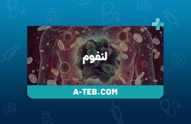 لنفوم