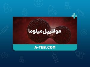 مولتیپل میلوما