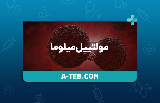 مولتیپل میلوما