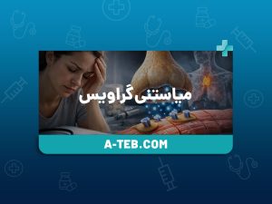 میاستنی گراویس