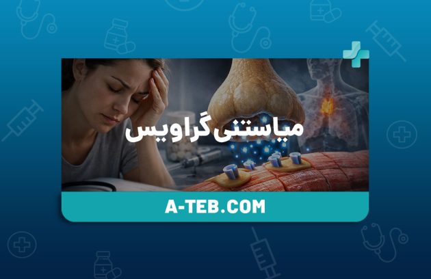 میاستنی گراویس