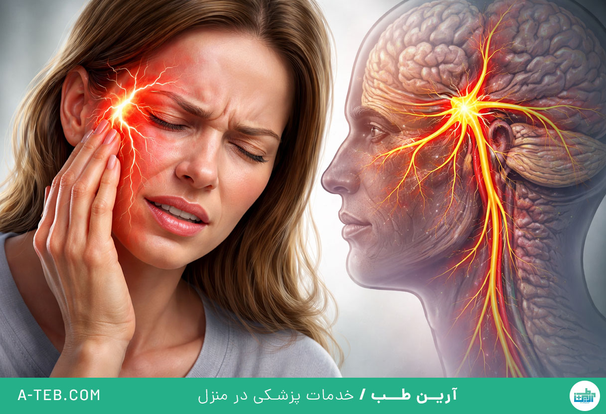 علائم نورالژی عصب سه قلو