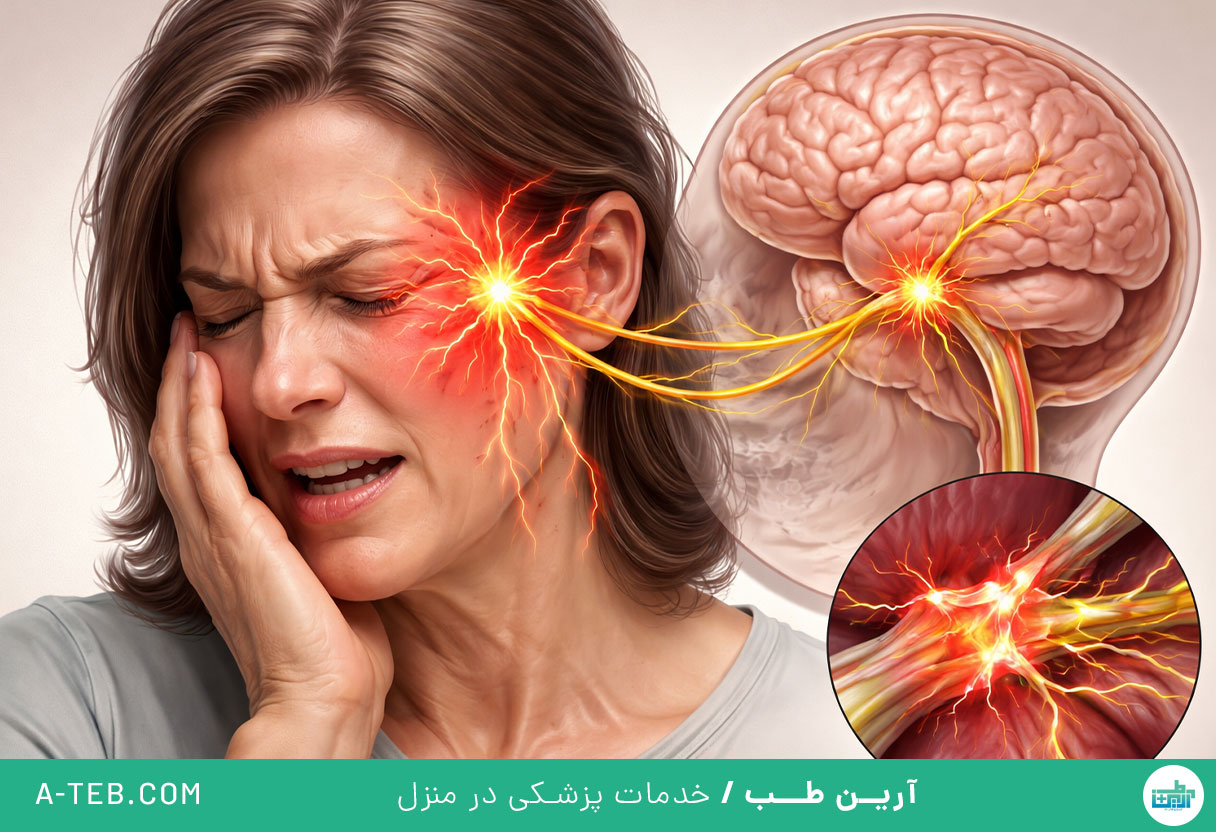 درمان نورالژی عصب سه قلو