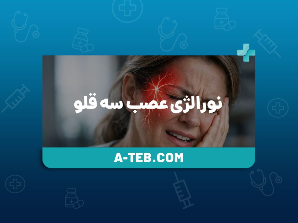 نورالژی عصب سه قلو