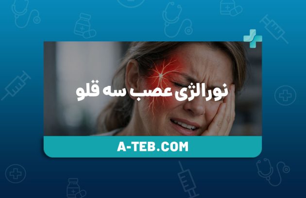 نورالژی عصب سه قلو