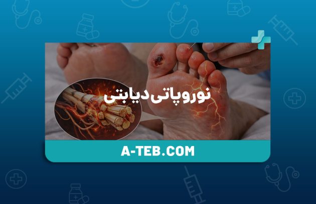 نوروپاتی دیابتی