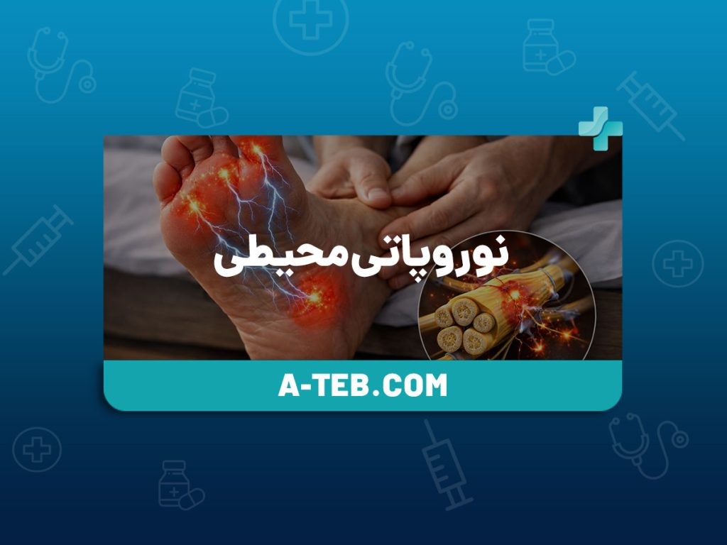 نوروپاتی محیطی