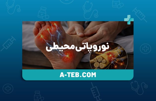 نوروپاتی محیطی