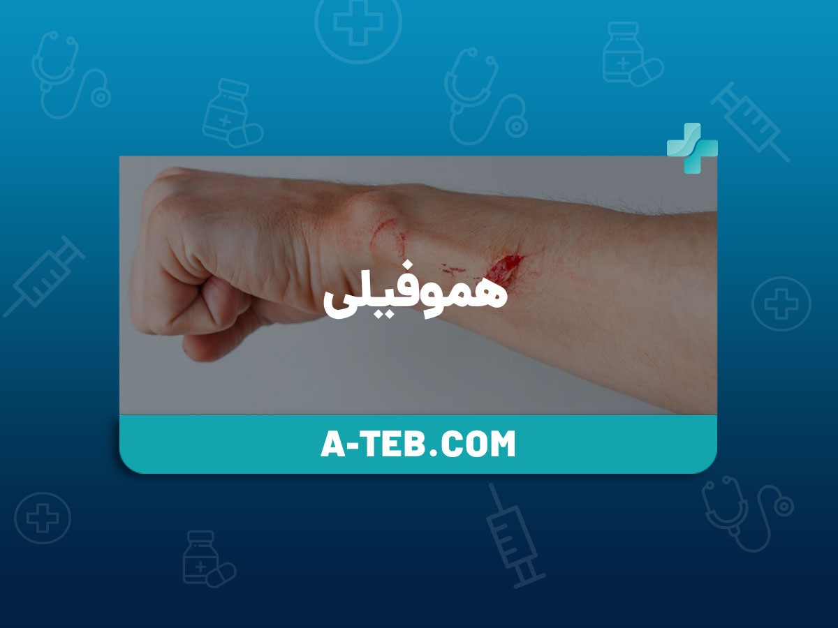 هموفیلی