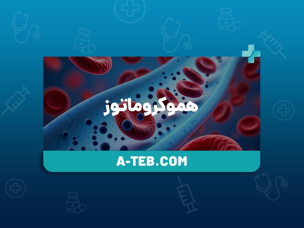 هموکروماتوز