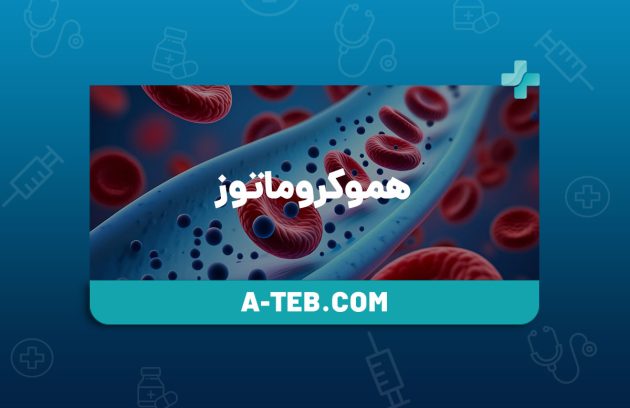 هموکروماتوز