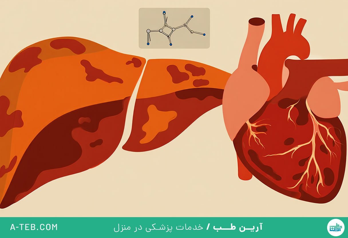 علائم هموکروماتوز