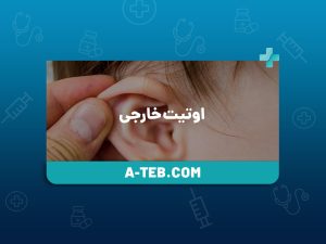 اوتیت خارجی