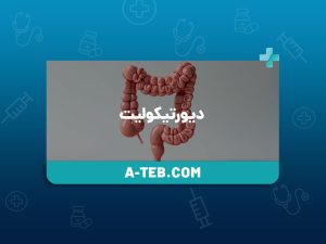 دیورتیکولیت