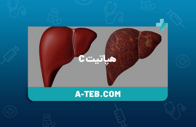 هپاتیت c