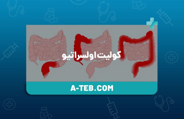 کولیت اولسراتیو