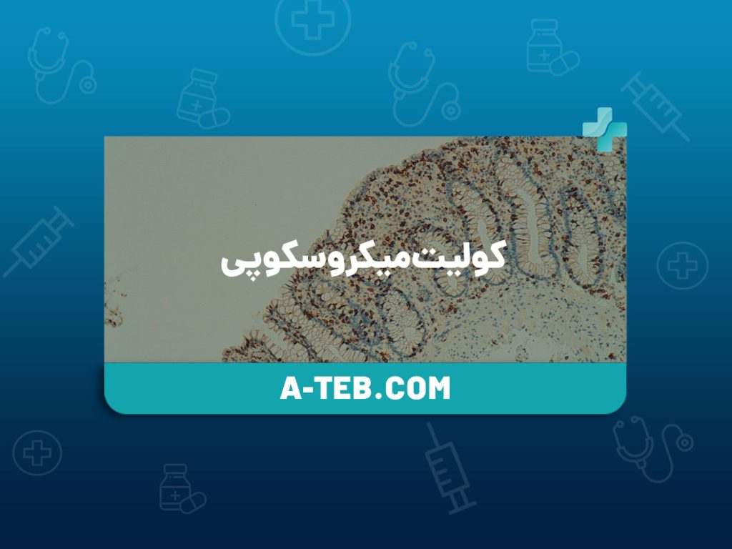 کولیت میکروسکوپی