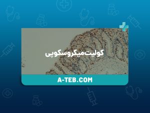 کولیت میکروسکوپی