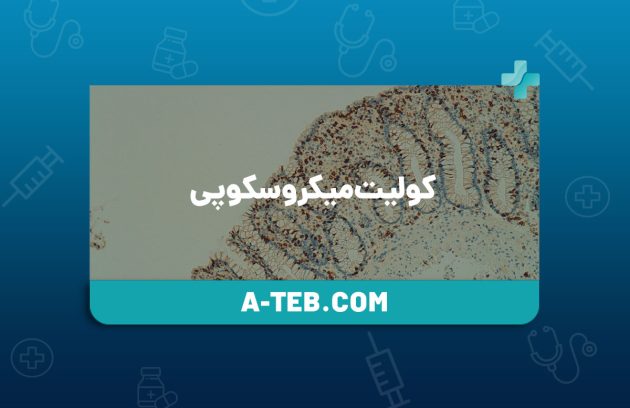 کولیت میکروسکوپی