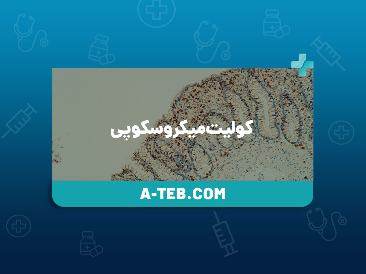 کولیت میکروسکوپی