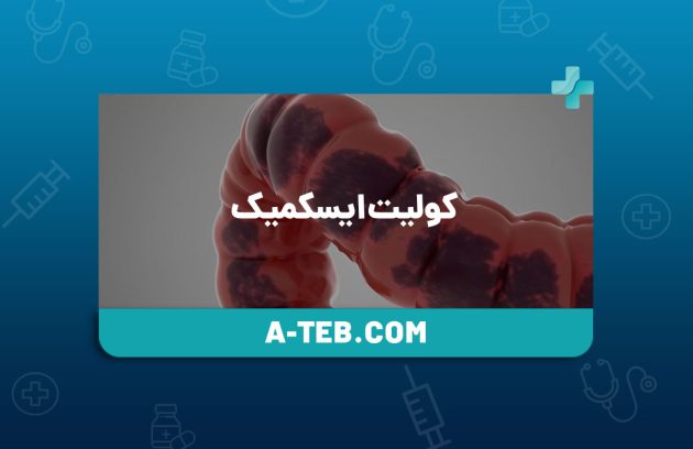 کولیت ایسکمیک