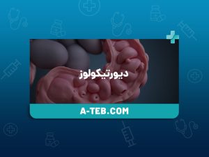 دیورتیکولوز