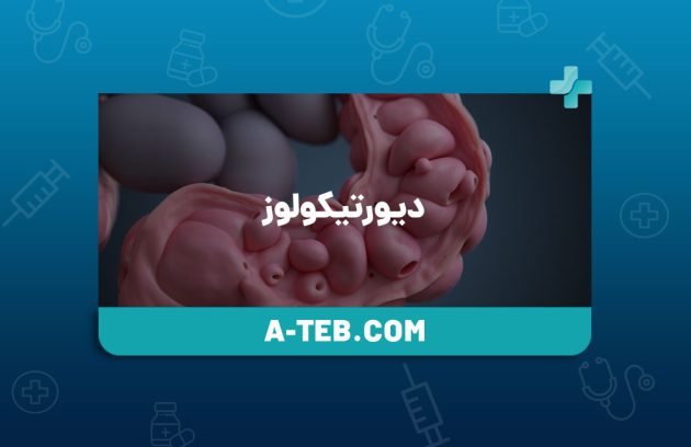 دیورتیکولوز