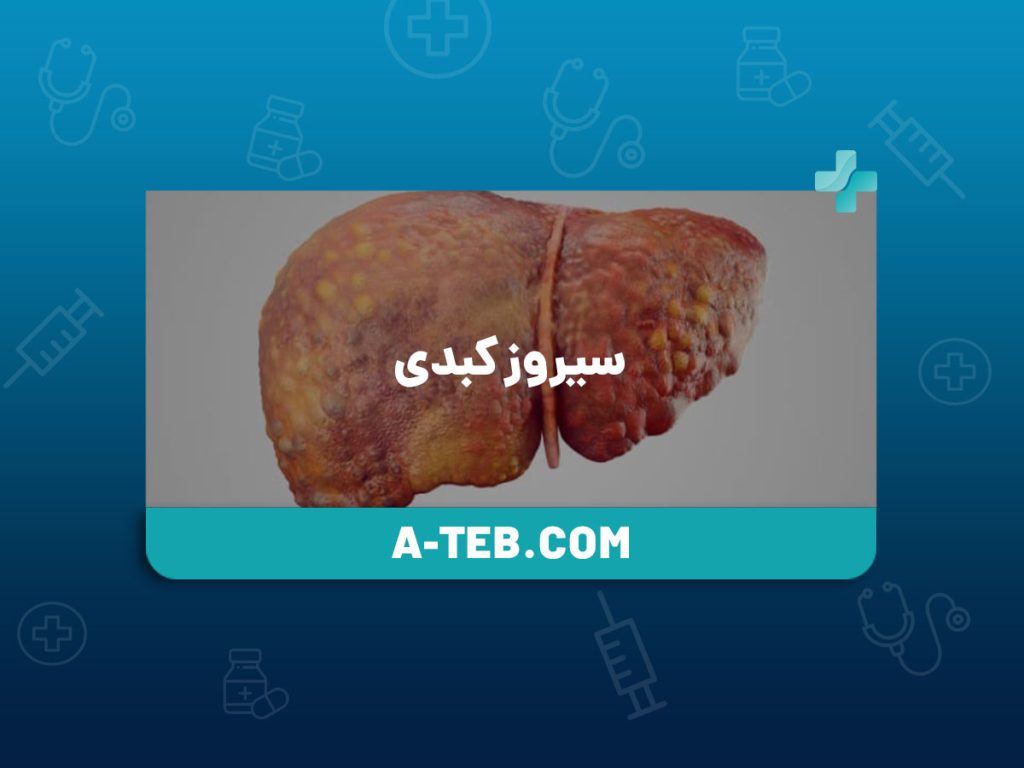 سیروز کبدی