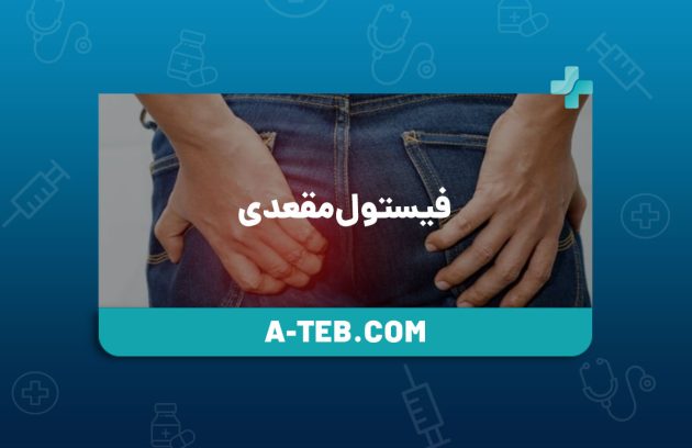 فیستول مقعدی
