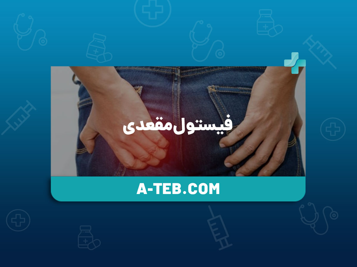 فیستول مقعدی