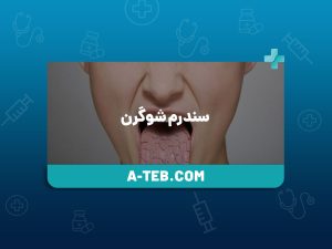 سندرم شوگرن
