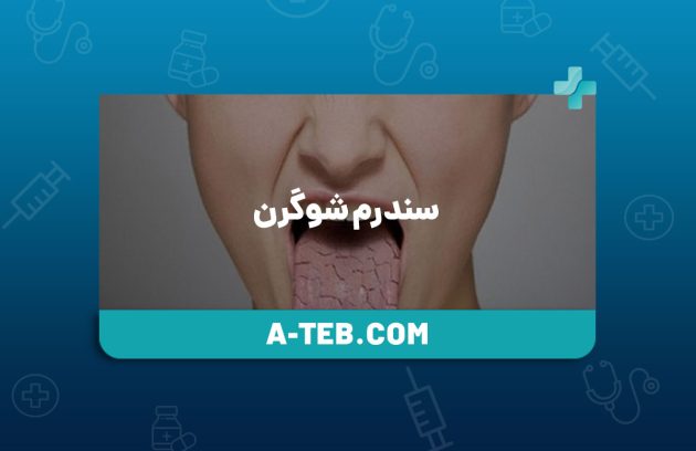 سندرم شوگرن