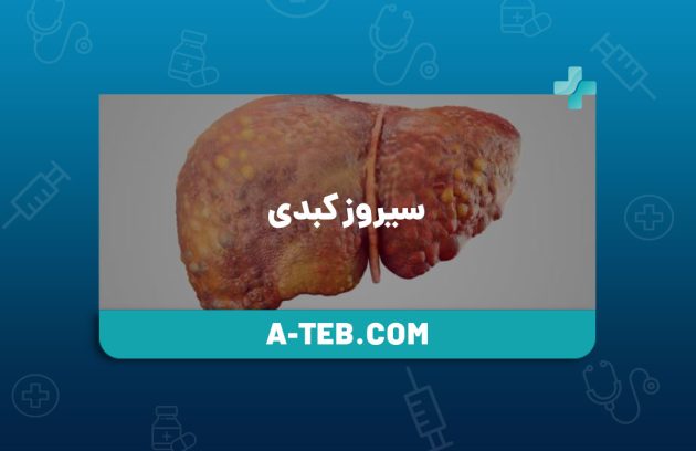 سیروز کبدی