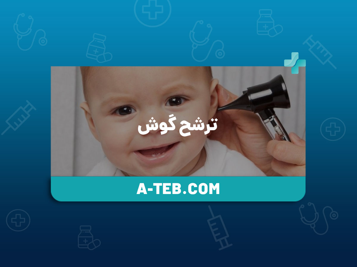 ترشح گوش