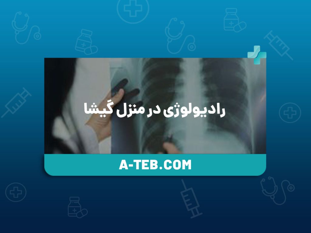 رادیولوژی در منزل گیشا