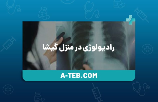 رادیولوژی در منزل گیشا